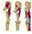 Ознаки закритого перелому кісток кінцівок